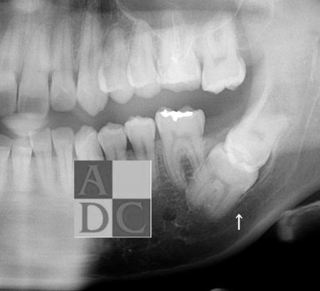 歯科用ｃｔ 中野坂上の歯医者 アマリ歯科クリニック ページ 2 ページ 2